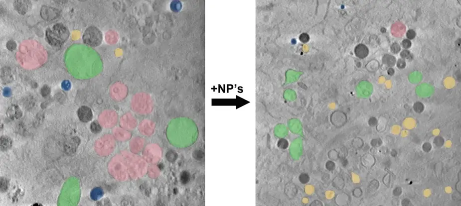 Zelle vor und nach Aufnahme von Nanopartikeln © James McNally/HZB